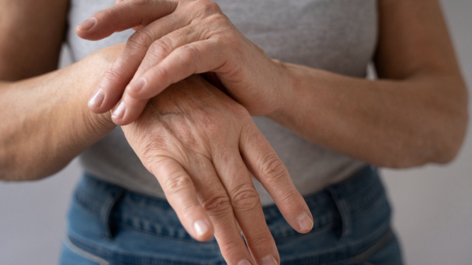 Osteoporosis: qué es, etapas y programas preventivos de riesgo de fracturas en la menopausia